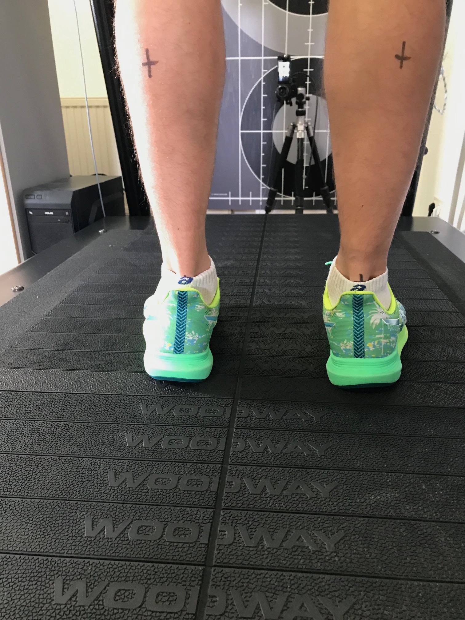 Laufanalyse - Überpronation | SCHORK Sports Laufanalyse - Überpronation - Erfahrungsbericht einer Läuferin zur Laufanalyse | SCHORK Sports Freinsheim