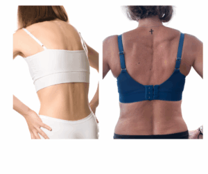 Rückengesundheit für Läufer und Läuferinnen | SCHORK Sports